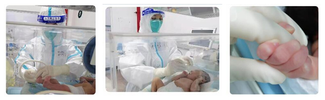 护士每天三次给宝宝做口腔护理，每隔两个小时更换宝宝脚趾头上监测血氧的探头，以确保血液循环顺畅。