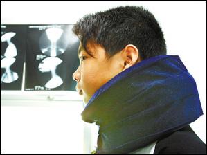 生理弯曲消失,14岁少年沉迷游戏患上颈椎病