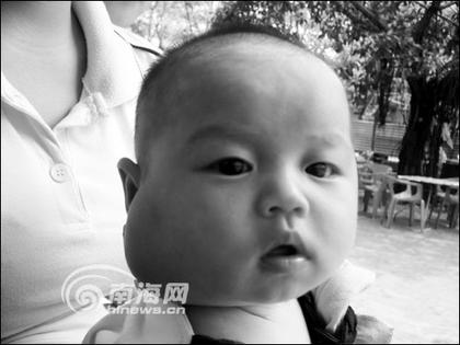 昌江3个月婴儿脸肿不消 多家医院查不出病因
