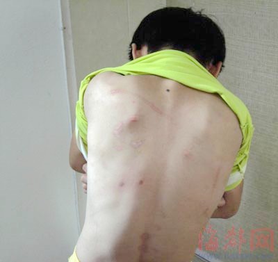 女孩遭生父3年毒打,多次被强奸